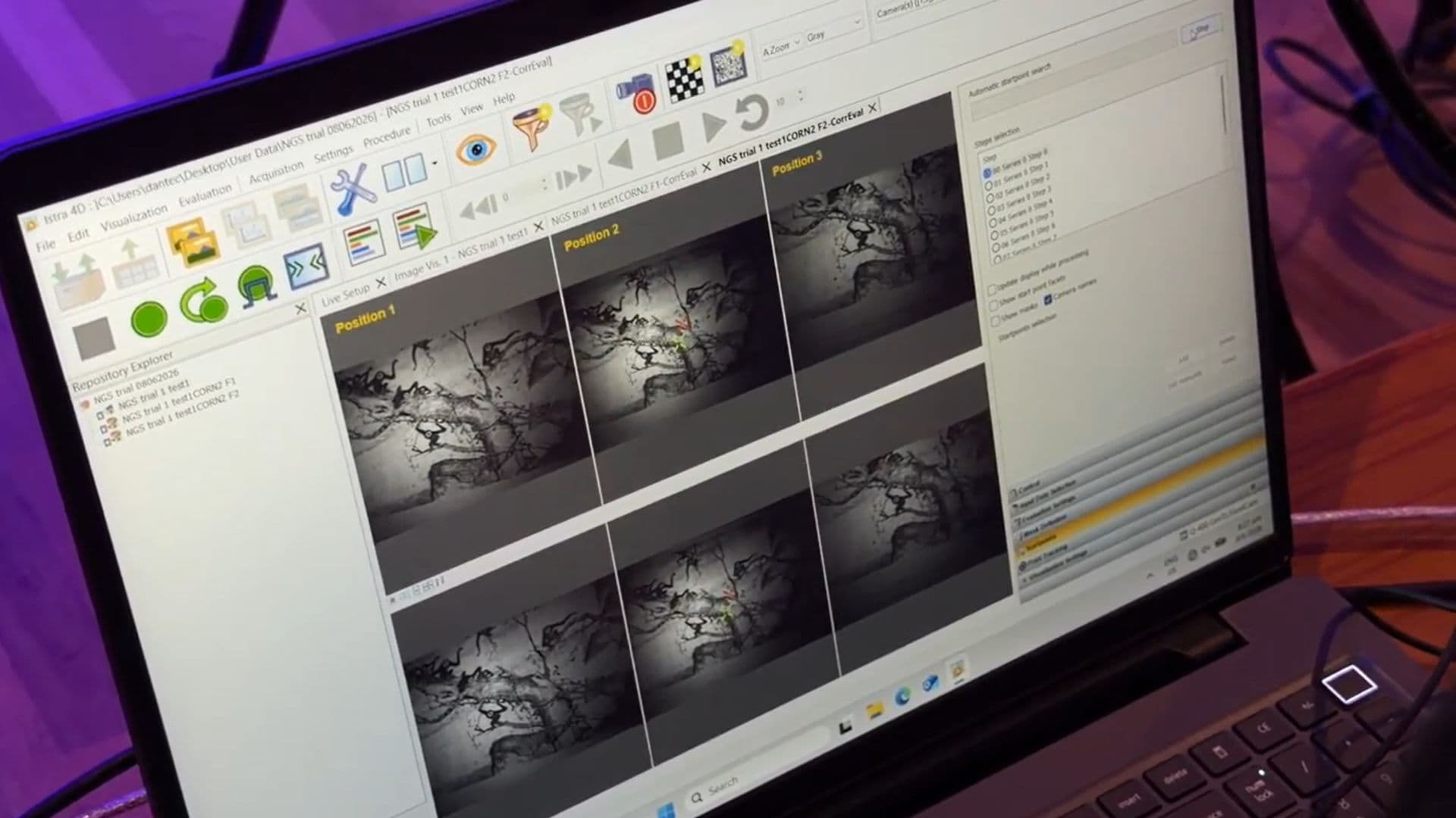 A laptop screen displays specialized software with multiple grayscale images of an artwork over time.
