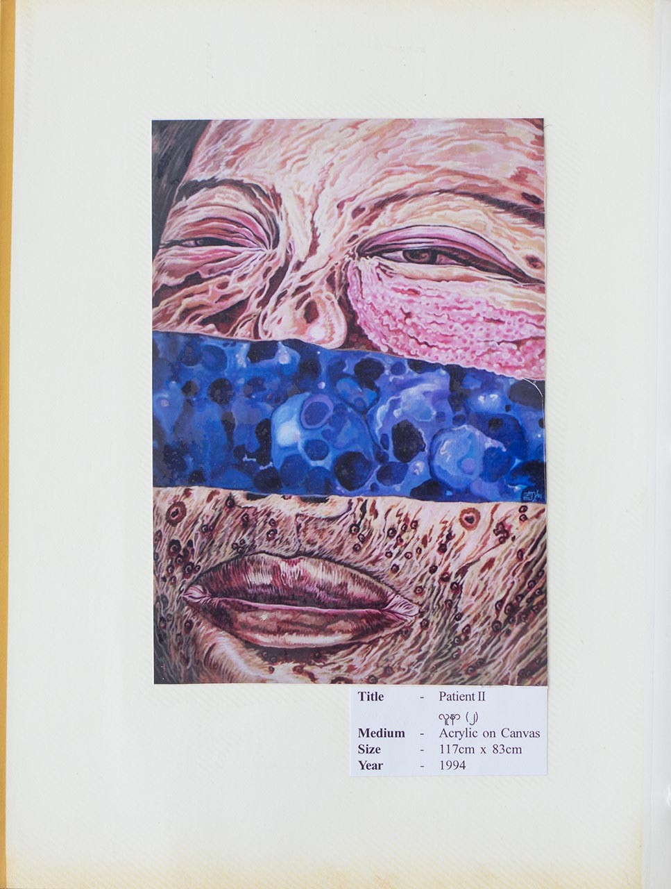 Patient II